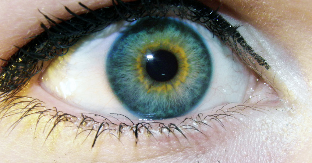 Heterochromia Iridum at emaze Presentation