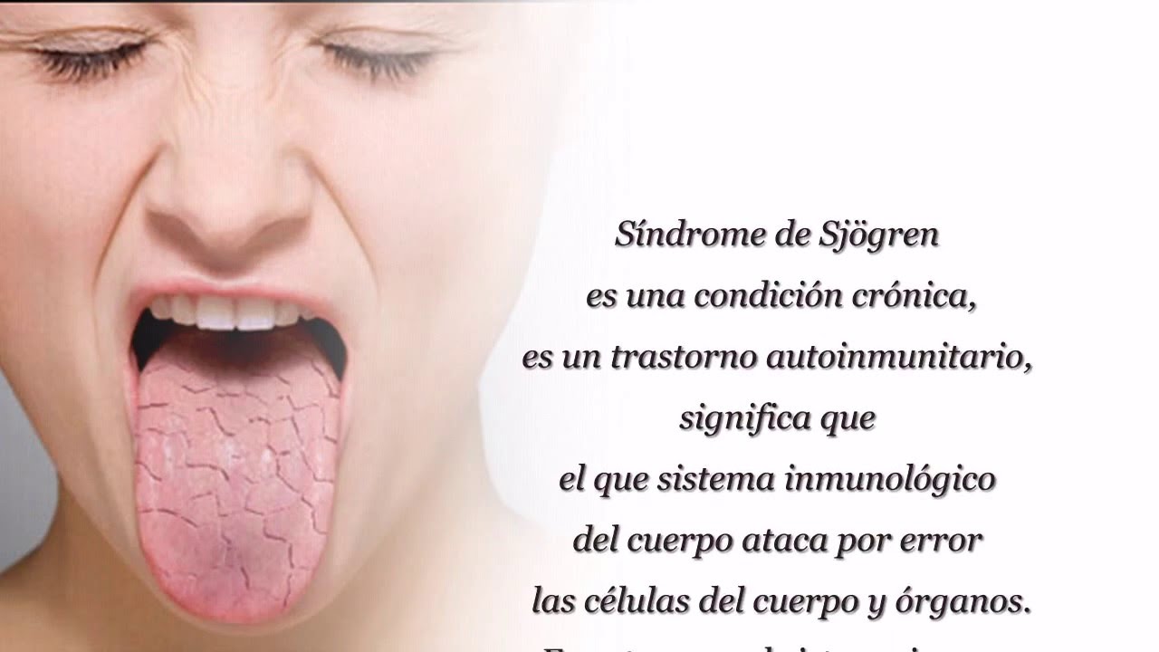 Alimentos recomendados para el sindrome de sjogren