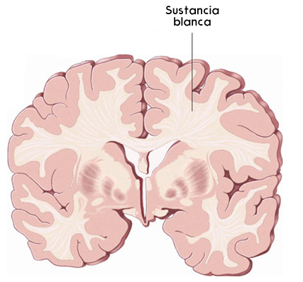 Brain matter. White matter and Gray matter. White and Gray matter. Gray matter Brain. Gray and White matter of the Brain matter.