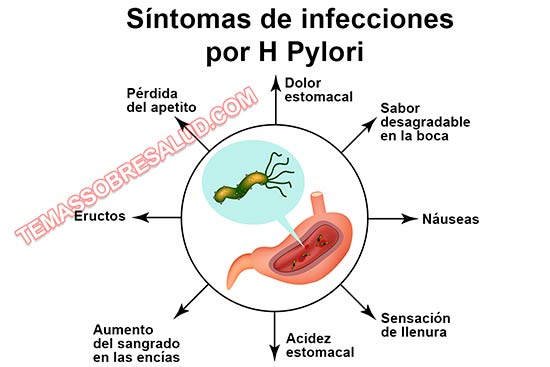 helicobacter pylori sintomas en espanol