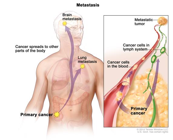 Cancer Powerpoint at emaze Presentation