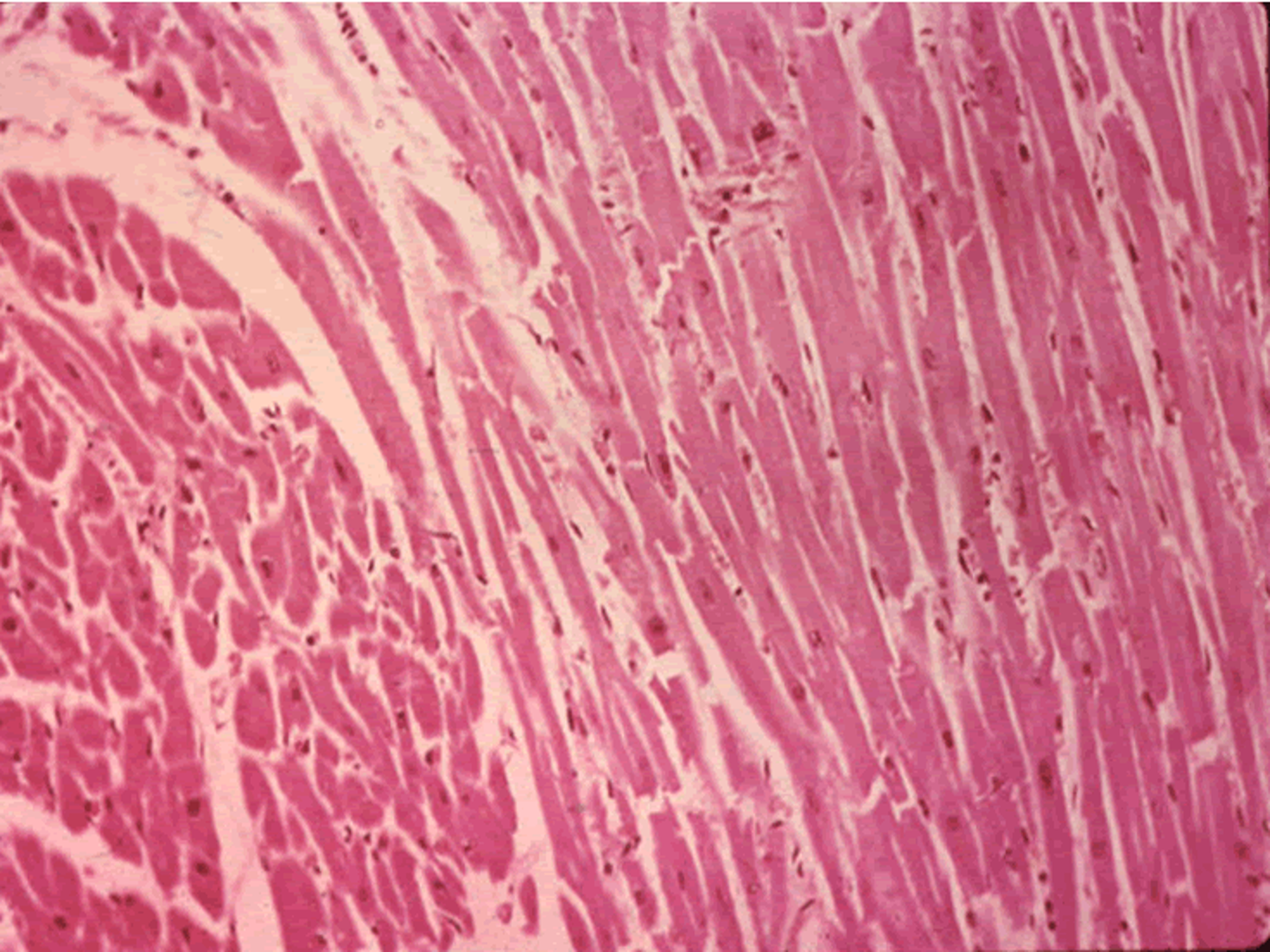 Клетка сердечной поперечно полосатой мышечной ткани