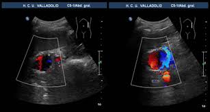 doppler ultrasound pregnancy for nclex
