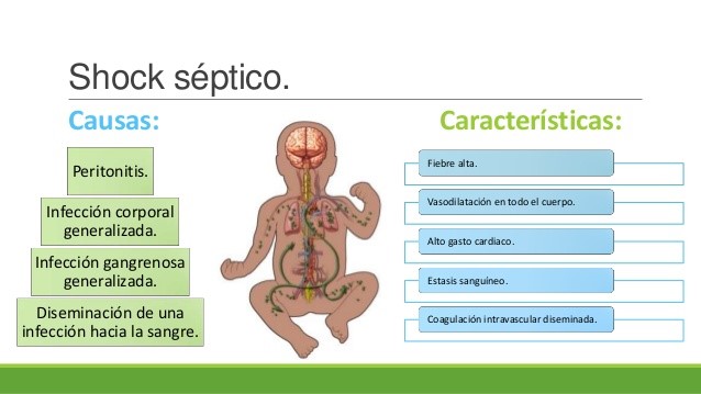 SHOCK SEPTICO at emaze Presentation