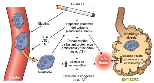 fisiopatología del enfisema