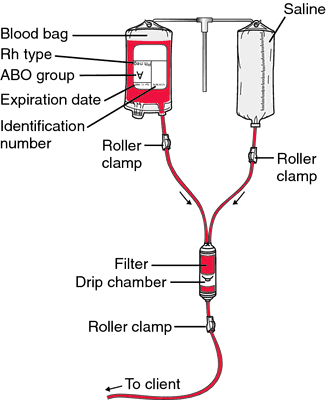 Y Tubing for Blood on emaze