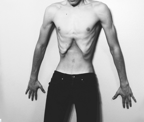 Kuvahaun tulos haulle anorexia tumblr