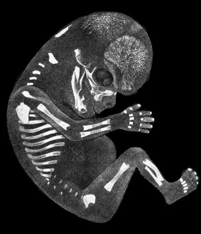 Патология жабер у человека. Эмбриология человека. Скелет эмбриона человека.