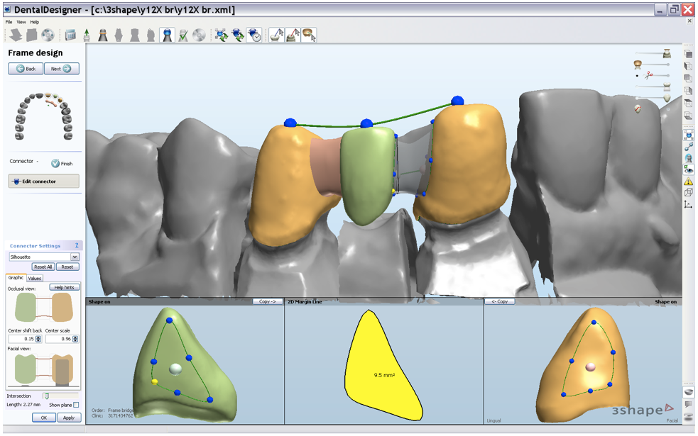 SISTEMA CAD CAM at emaze Presentation