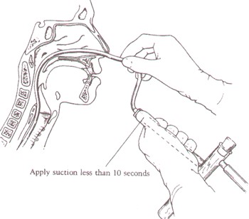 Suctioning For Tuesday.pptx On Emaze