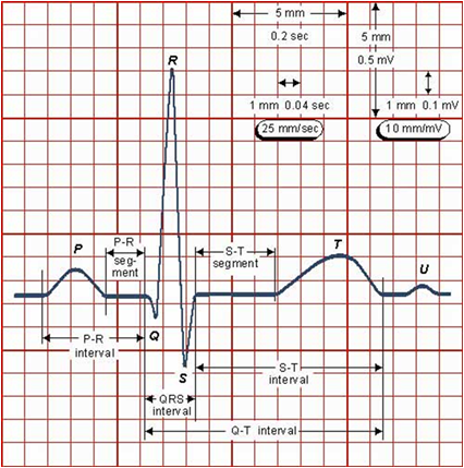 ECG on emaze