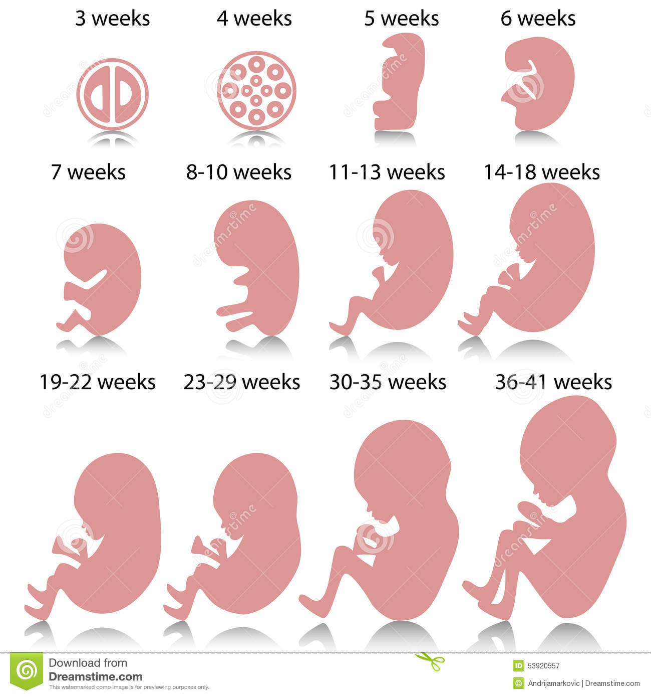 Congenital Anomalies in Human Embryos IntechOpen