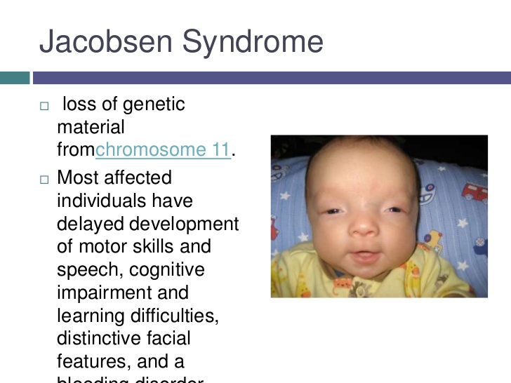 Jacobsens SyndromMia at emaze Presentation