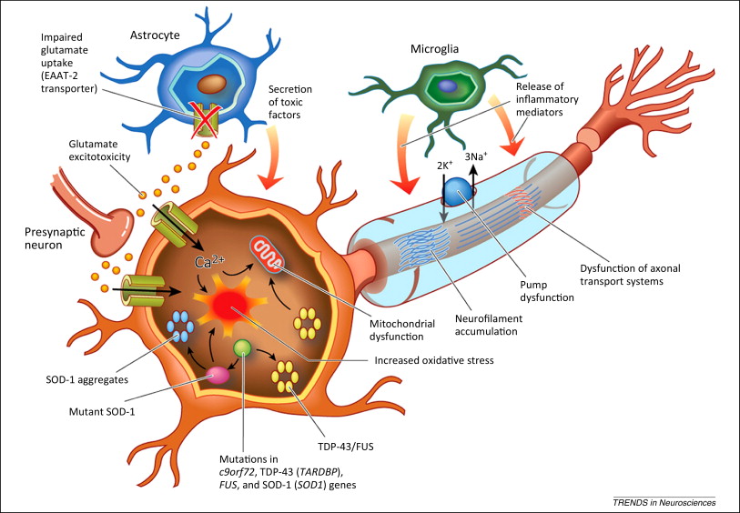 an analysis of amyotrophic lateral sclerosis als Analysis of neurotrophic factors in limb and extraocular muscles of mouse model of amyotrophic lateral sclerosis vahid m harandi1, susanne lindquist2, shrikant shantilal kolan1, thomas bra¨nnstro¨m3, jing-xia liu1. an analysis of amyotrophic lateral sclerosis als Analysis of neurotrophic factors in limb and extraocular muscles of mouse model of amyotrophic lateral sclerosis vahid m harandi1, susanne lindquist2, shrikant shantilal kolan1, thomas bra¨nnstro¨m3, jing-xia liu1.