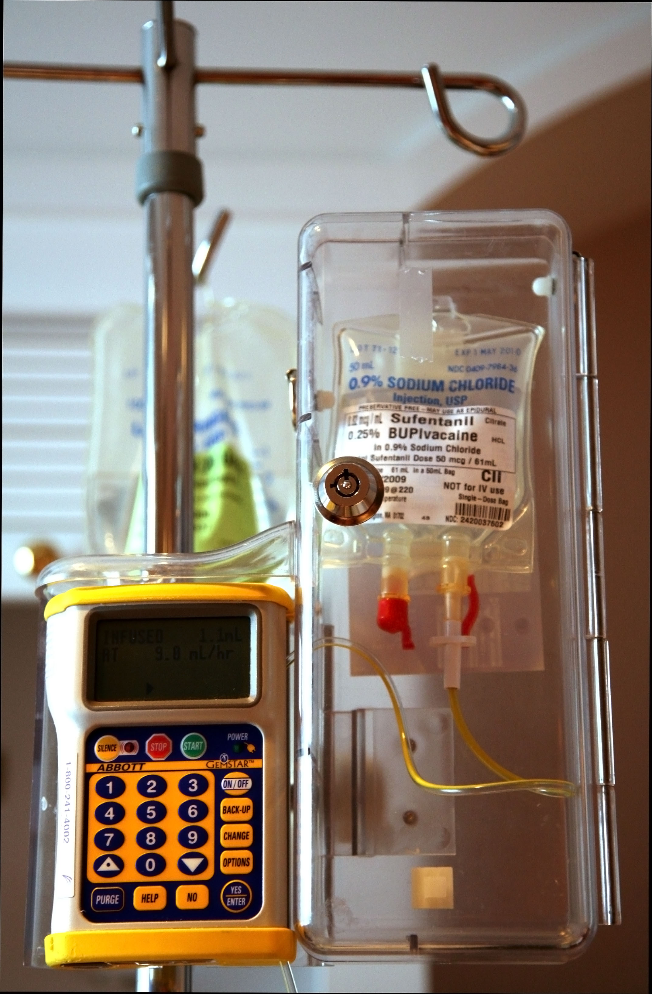 Epidural Pumps on emaze