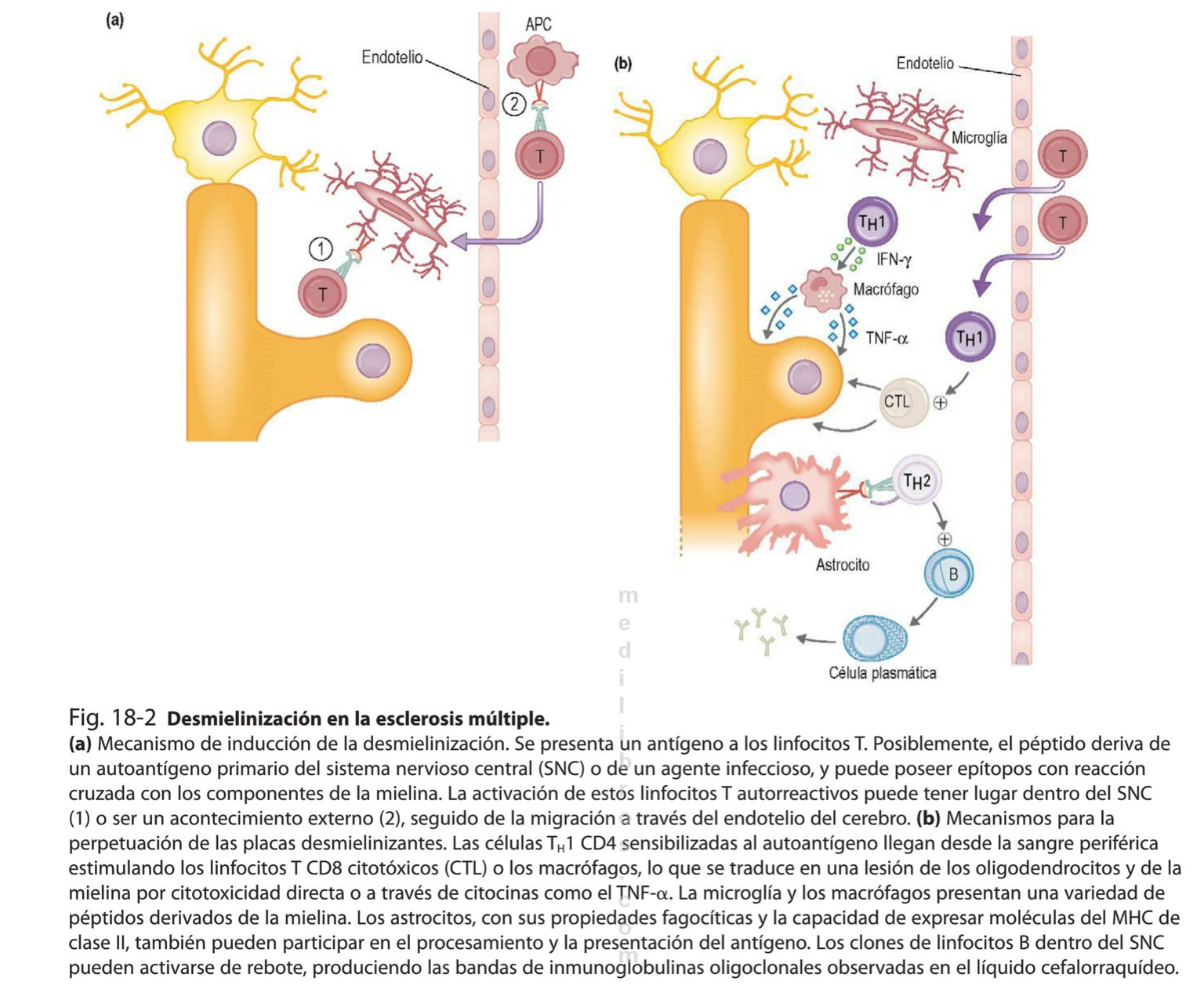 Esclerosis Multipl On Emaze