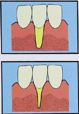 Caso clínico 1 CAF on emaze
