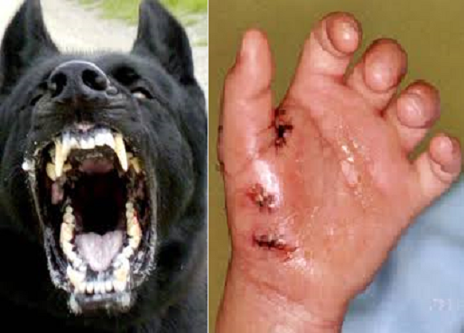 How Long Between Dog Bite And Rabies / Rabies Prevention, Symptoms, and