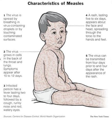 vomiting vaccine side effect vomiting vaccine side effect