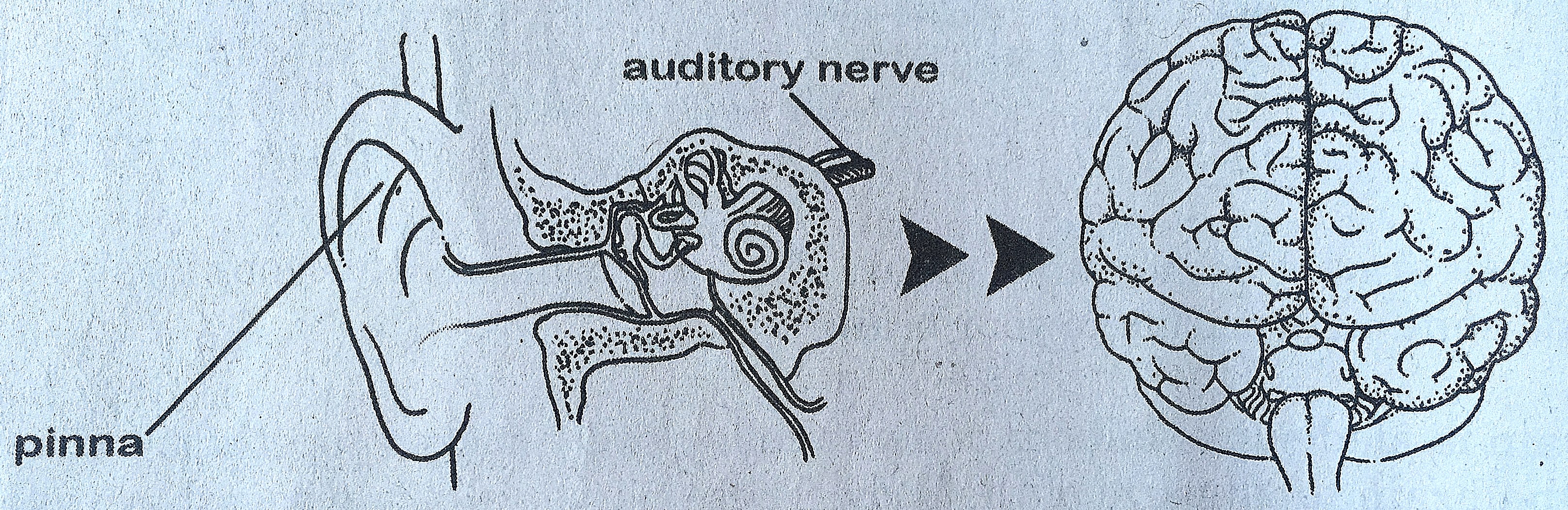 Звук слух мозг. Мозг с ушами. Слуховой анализатор мозг. Строение ушей анатомия мозга. Слуховой нерв и мозг.