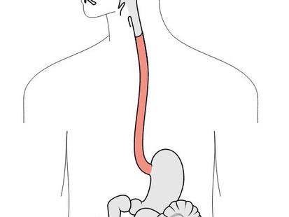 Cartoon Esophagus Pictures - impremedia.net female brain wiring diagram 