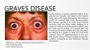 Graves Disease at emaze Presentation