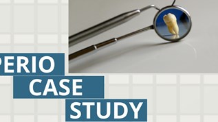 Perio case study at emaze Presentation