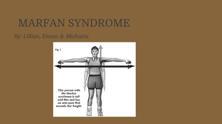 Marfan Syndrome at emaze Presentation