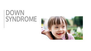 down syndrome at emaze Presentation