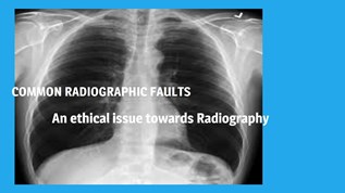 COMMON RADIOGRAPHIC FAULTS.pptx at emaze Presentation