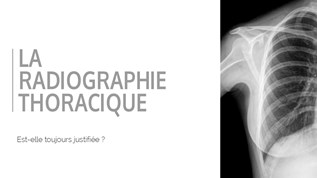 Radiographie Thoracique at emaze Presentation