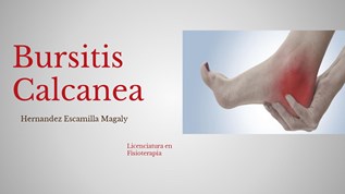 Bursitis Calcanea at emaze Presentation