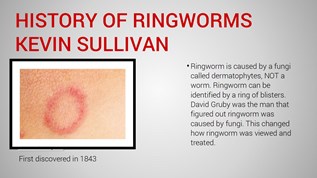 History of ringworm by Kevin Sullivan at emaze Presentation