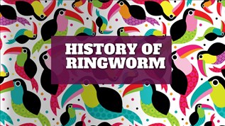 History of ringworm at emaze Presentation