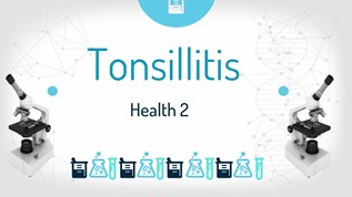 Tonsillitis at emaze Presentation