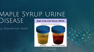 maple syrup urine disease in adults