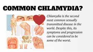 Chlamydia at emaze Presentation